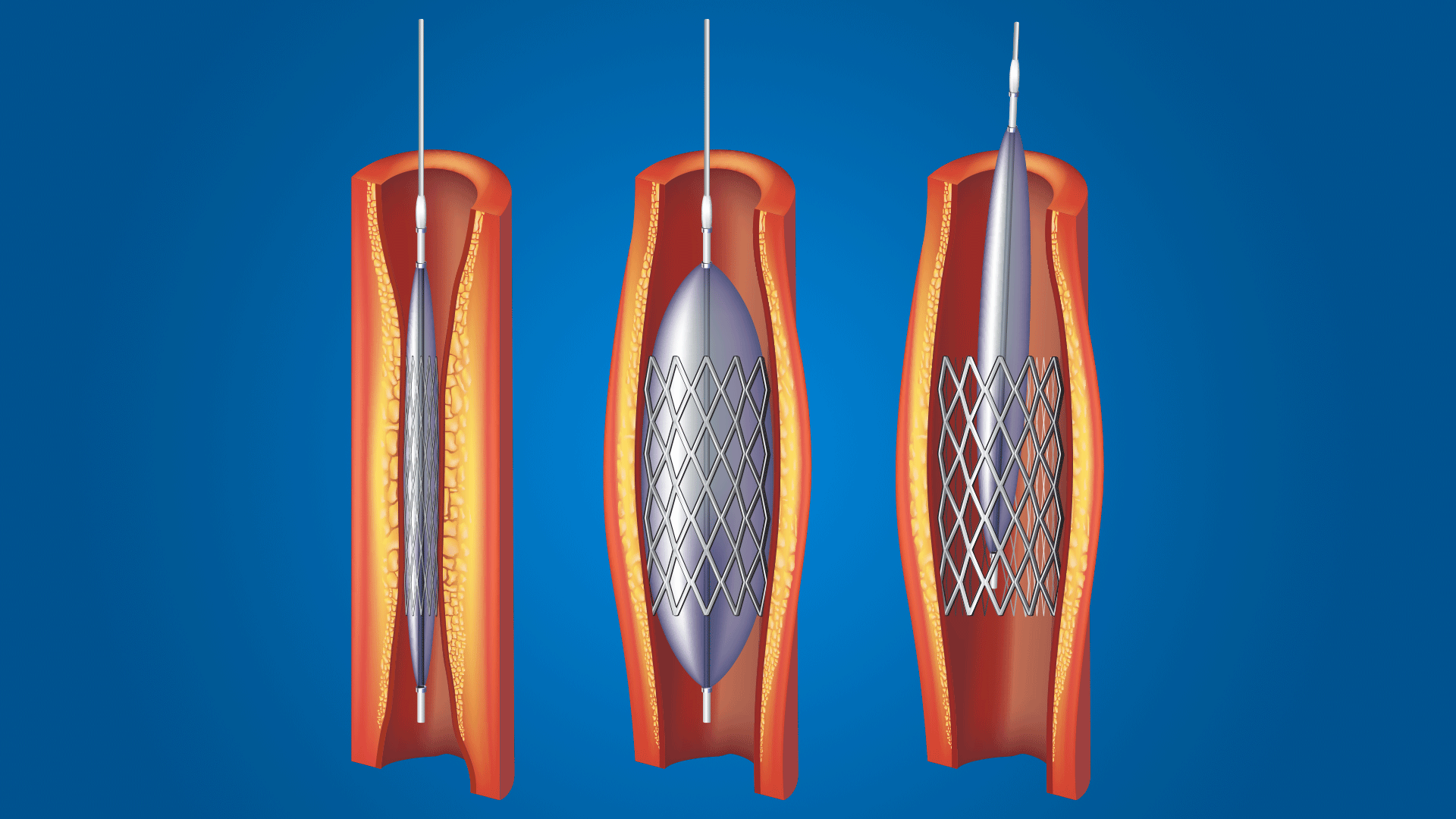 1-Man-holding-heart Man holding heart