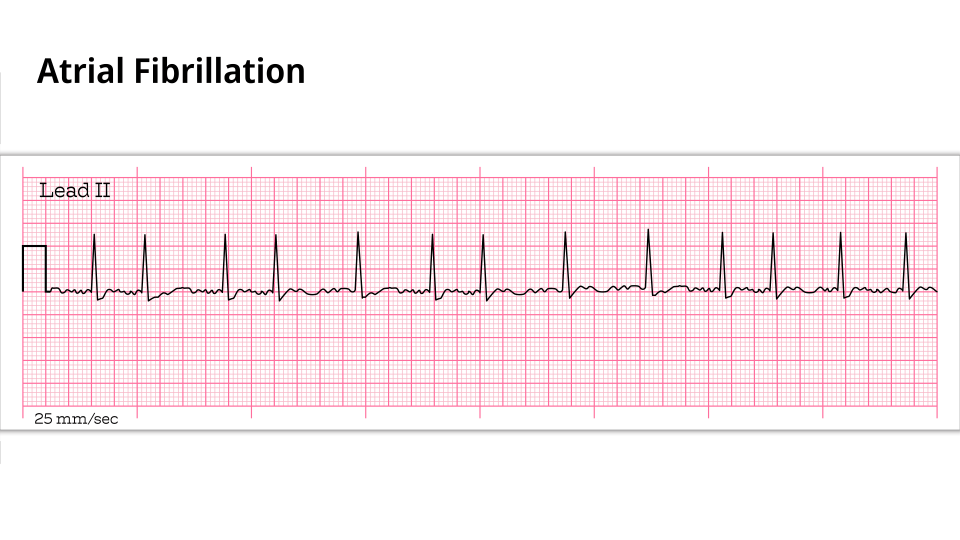 1-Man-holding-heart Man holding heart
