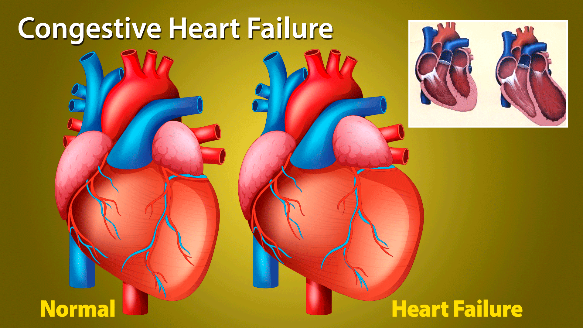 1-Man-holding-heart Man holding heart