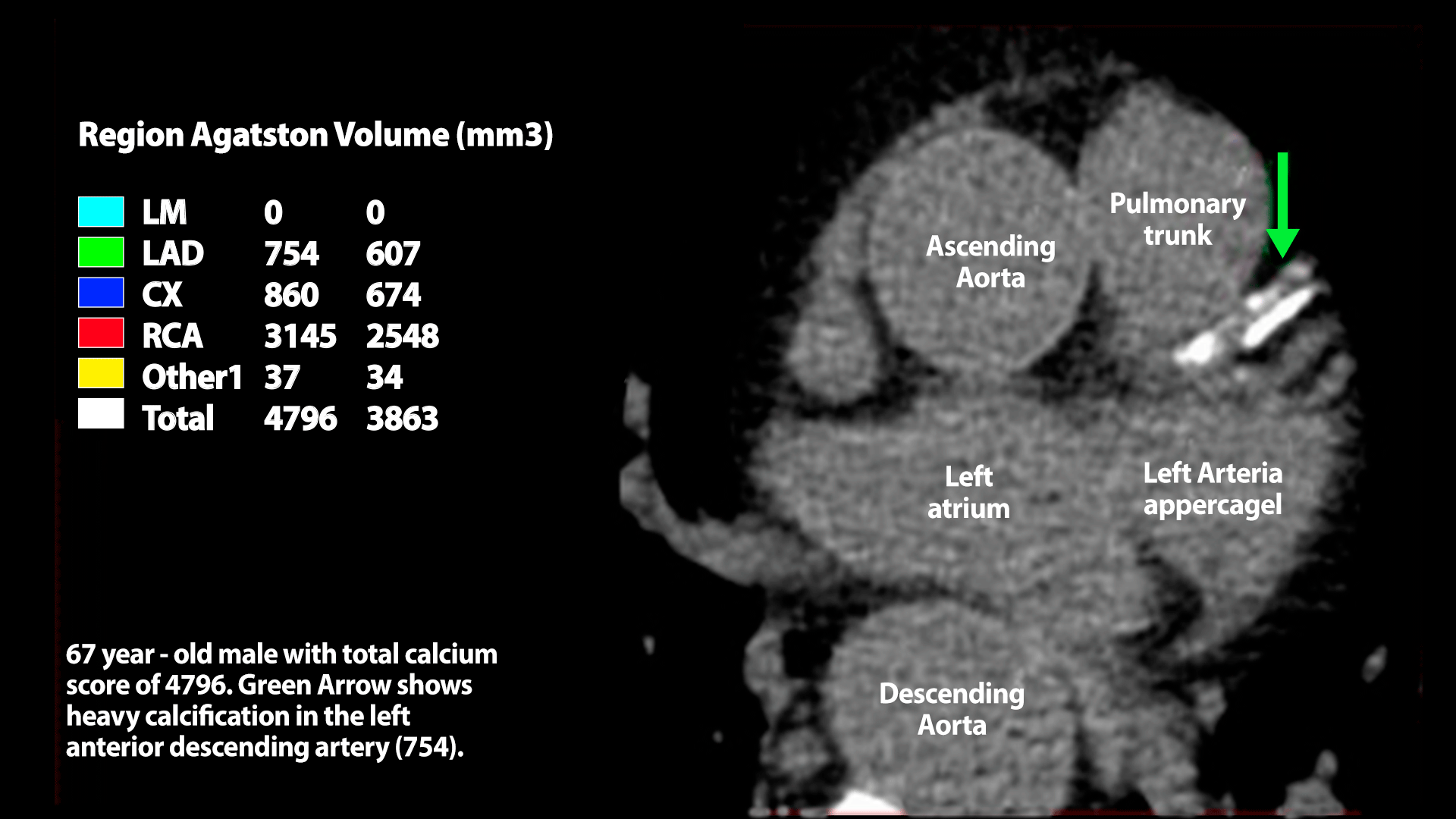 1-Man-holding-heart Man holding heart